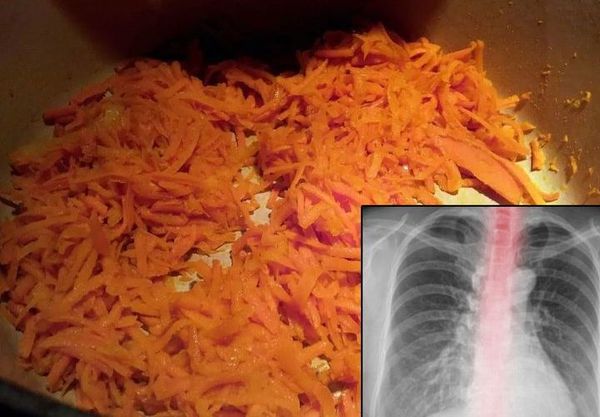 Syrup with Honey and Carrots: A Natural Remedy to Get Rid of Phlegm