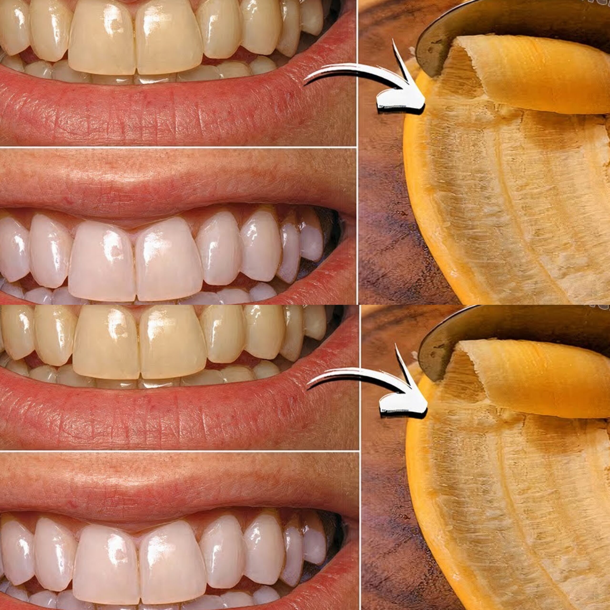 The Hidden Dental Secret: Unlock a Brighter Smile with Banana Peel