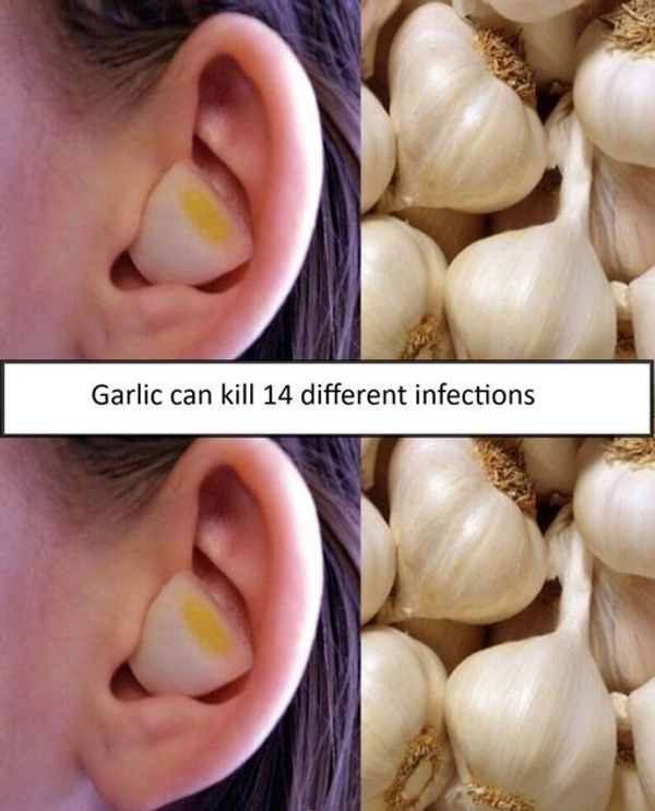 Garlic: Nature’s Super Remedy