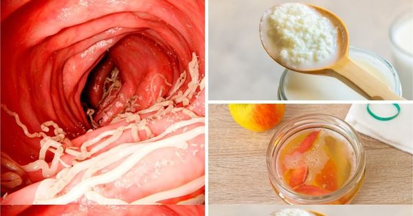 Winning the Battle Against Intestinal Worms: 5 Natural Foods to the Rescue