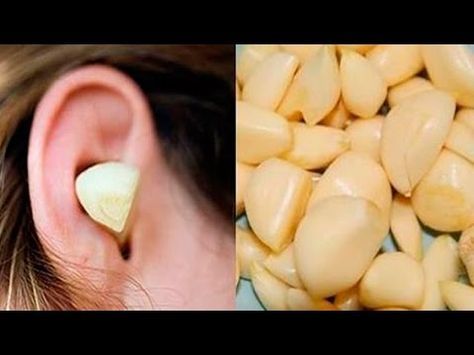 The Astonishing Benefits of Garlic in Your Ear: An Old-School Remedy Revealed