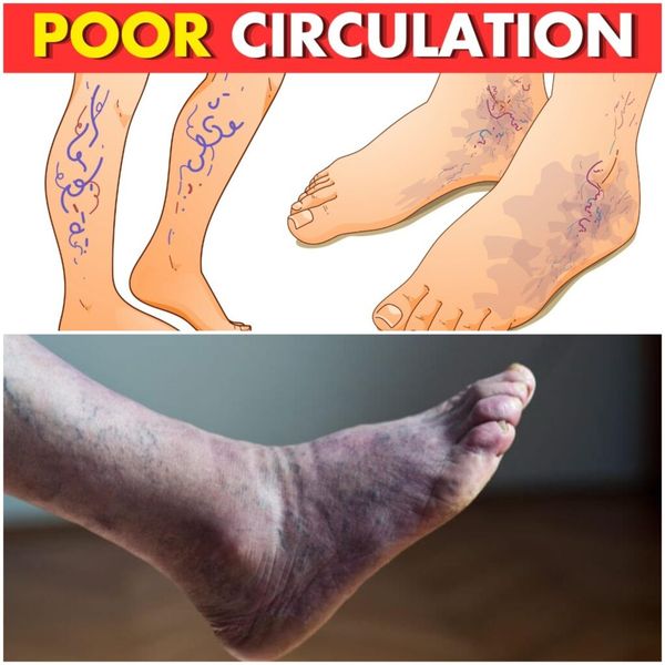 Warning Signs of Poor Circulation