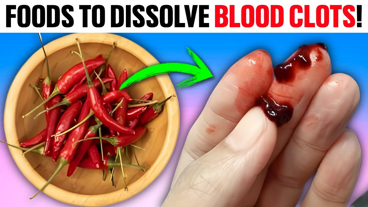 Unlock Nature’s Pharmacy: 5 Foods That Naturally Dissolve Blood Clots