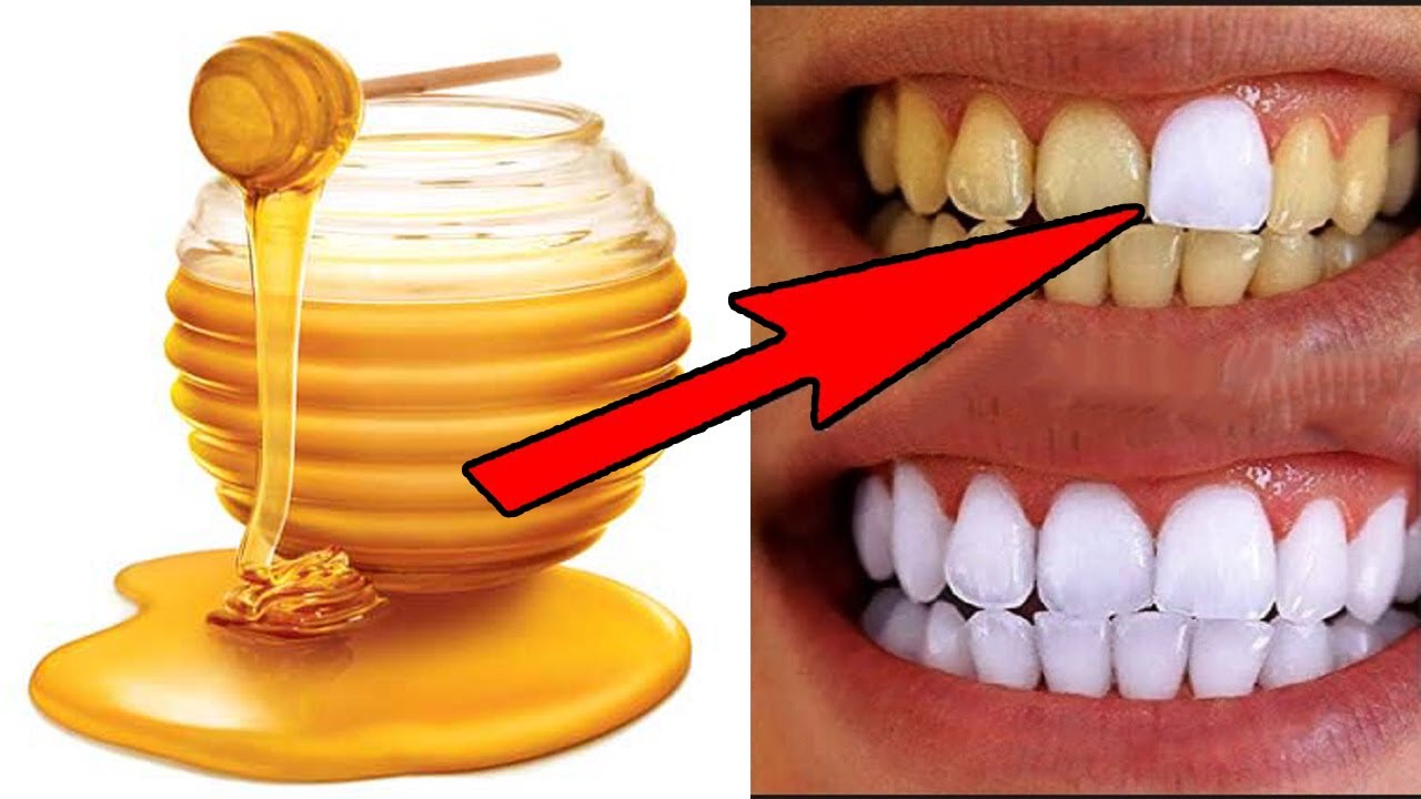 Sweet Smiles: The Surprising Role of Honey in Teeth Whitening