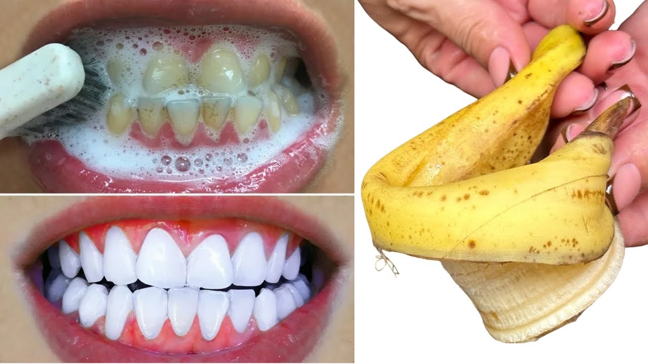 Brighten Your Smile in a Blink: The Banana Peel Miracle