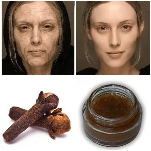 DIY Anti-Aging Clove Cream: Rejuvenate Your Skin Naturally