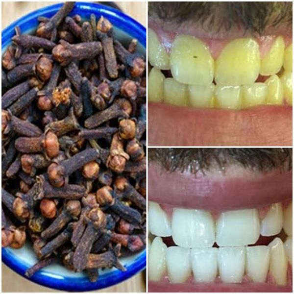 DIY Teeth-Whitening Paste: Brighten Your Smile Naturally