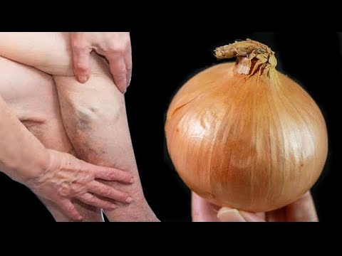 Soothe Your Aches with Mom’s Natural Onion Remedies