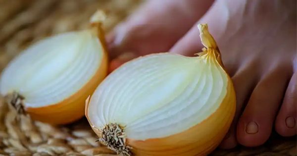 Unleash the Incredible Healing Power of Onions: A Natural Solution for Better Health