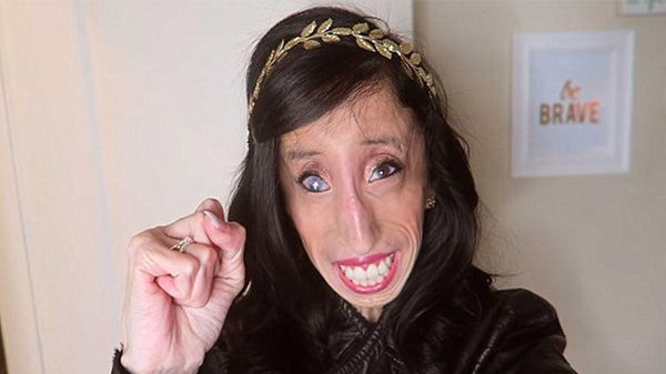 Lizzie Velásquez