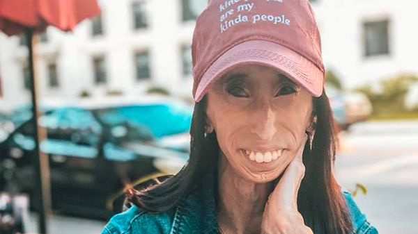 Lizzie Velásquez